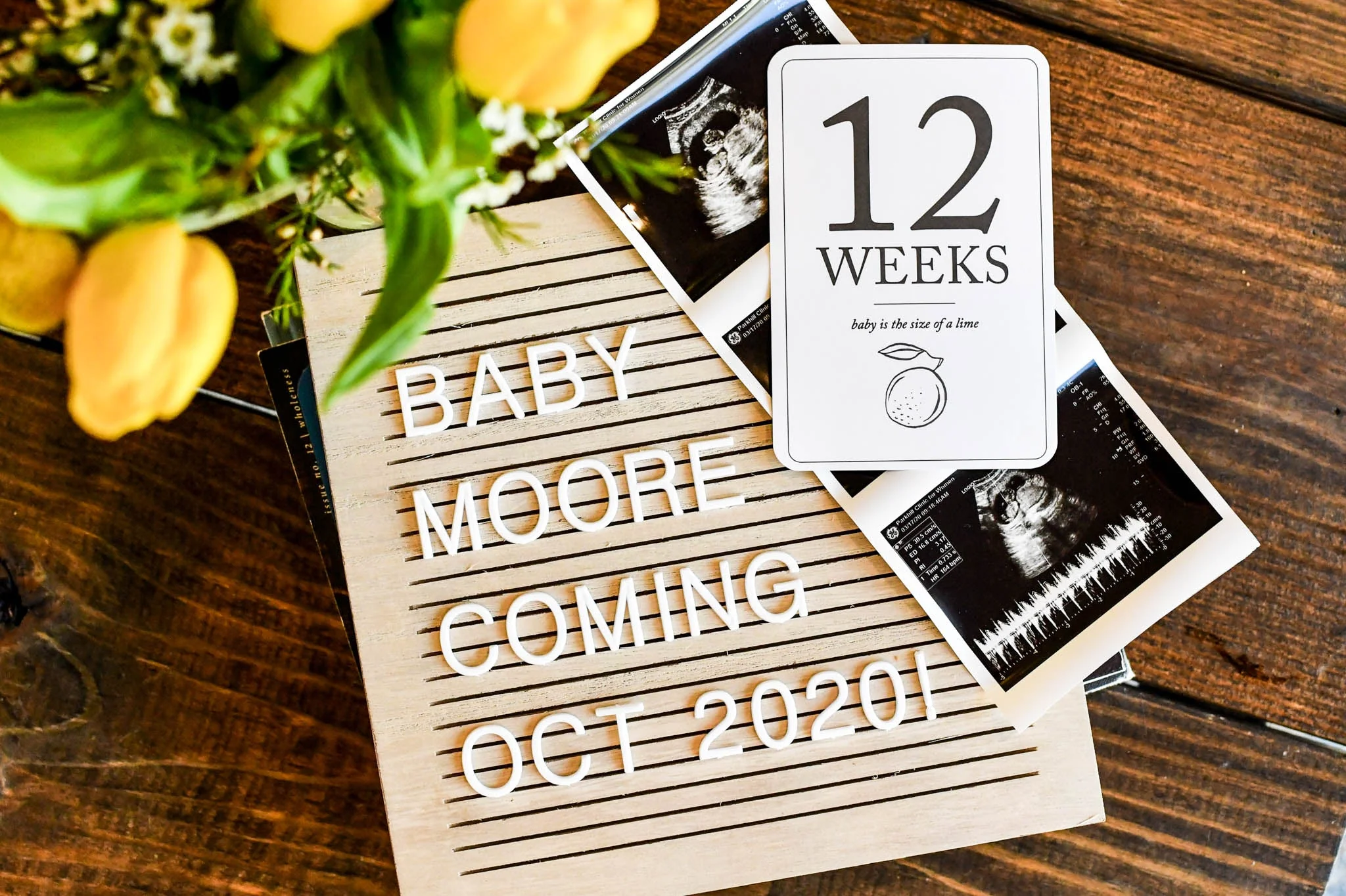 Pregnancy Milestone Cards | Baby Announcement | Expecting Mom Gift - Image 4